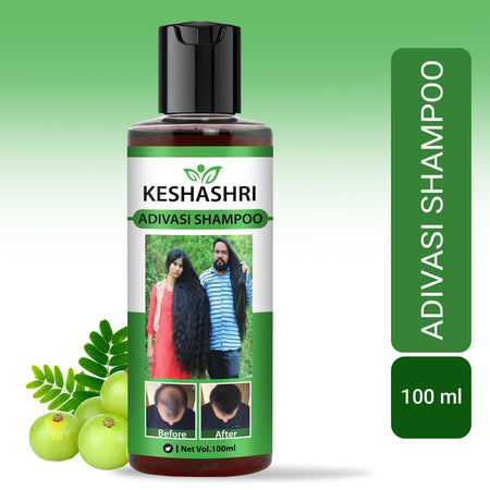 Keshashri Adivasi Shampoo (BUY 1 GET 1 FREE)